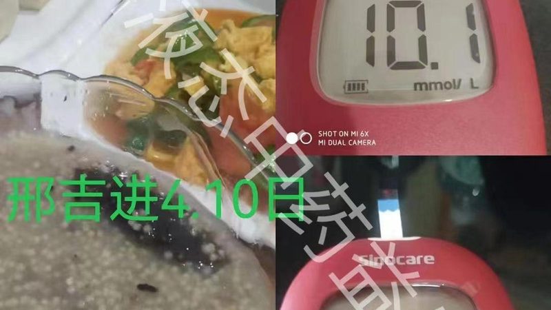维生素B6与B2：治脱发效果对比解析